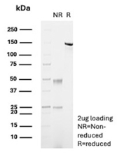 Carboxypeptidase A1 Antibody SDS-PAGE Analysis. SDS-PAGE analysis of recombinant mouse monoclonal Carboxypeptidase A1 antibody, clone rCPA1/8689, under non-reducing (NR) and reducing (R) conditions. Under non-reducing conditions, the intact antibody migrates as a single band at approximately 150 kDa, consistent with full IgG structure, while reducing conditions resolve the antibody into heavy chain (~50 kDa) and light chain (~25 kDa) bands. This pattern confirms expected antibody integrity and disulfide bond-dependent structure.