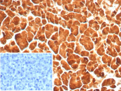 Carboxypeptidase A1 Antibody Pancreas IHC. Immunohistochemistry of Carboxypeptidase A1 / CPA1 in FFPE human pancreas tissue using recombinant mouse monoclonal Carboxypeptidase A1 antibody, clone rCPA1/8689. Strong HRP-DAB brown cytoplasmic staining highlights pancreatic acinar cells, consistent with the enzymeâs role in digestive protein processing, while nuclei are counterstained blue. The staining pattern shows uniform acinar cell labeling with minimal background. Inset: PBS was used in place of primary antibody as a negative control to confirm specificity of staining. Heat induced epitope retrieval was performed by boiling tissue sections in pH 9 10 mM Tris with 1 mM EDTA for 20 min followed by cooling prior to staining.