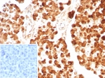 IHC staining of FFPE human pancreas tissue with CPA1 antibody (clone CPA1/8624R). Inset: PBS used in place of primary Ab (secondary Ab negative control). HIER: boil tissue sections in pH 9 10mM Tris with 1mM EDTA for 20 min and allow to cool before testing.