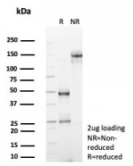 SDS-PAGE analysis of purified, BSA-free Adenylyl cyclase 8 antibody (clone ADCY8/7341) as confirmation of integrity and purity.