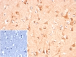 IHC staining of FFPE human brain tissue with Adenylyl cyclase 8 antibody (clone ADCY8/7341). Inset: PBS used in place of primary Ab (secondary Ab negative control). HIER: boil tissue sections in pH 9 10mM Tris with 1mM EDTA for 20 min and allow to cool before testing.