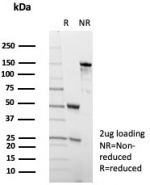 SDS-PAGE analysis of purified, BSA-free ADCY8 antibody (clone ADCY8/7573) as confirmation of integrity and purity.