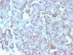 IHC staining of FFPE human salivary gland tissue with ADCY8 antibody (clone ADCY8/7573). HIER: boil tissue sections in pH 9 10mM Tris with 1mM EDTA for 20 min and allow to cool before testing.