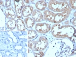 IHC staining of FFPE human kidney tissue with ADCY8 antibody (clone ADCY8/7573). Inset: PBS used in place of primary Ab (secondary Ab negative control). HIER: boil tissue sections in pH 9 10mM Tris with 1mM EDTA for 20 min and allow to cool before testing.