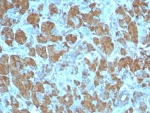 IHC staining of FFPE human pancreas tissue with CPA1 antibody (clone CPA1/8259R). HIER: boil tissue sections in pH 9 10mM Tris with 1mM EDTA for 20 min and allow to cool before testing.