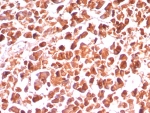 IHC staining of FFPE human pancreas tissue with CPA1 antibody (clone CPA1/8289R). HIER: boil tissue sections in pH 9 10mM Tris with 1mM EDTA for 20 min and allow to cool before testing.
