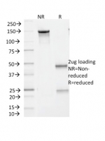 SDS-PAGE analysis of purified, BSA-free BRAF V600E antibody (clone V600E/1321) as confirmation of integrity and purity.