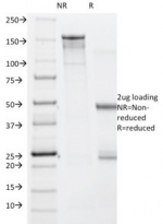 SDS-PAGE analysis of purified, BSA-free BRAF V600E antibody (clone V600E/1322) as confirmation of integrity and purity.