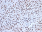 IHC staining of FFPE human tonsil tissue with EZH2 antibody (clone EZH2/6991). HIER: boil tissue sections in pH 9 10mM Tris with 1mM EDTA for 20 min and allow to cool before testing.