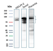 EZH2 Antibody Tissue and Cell Line WB. Western blot analysis of HDLM-2, human tonsil, and human placenta lysates using EZH2 / KMT6 recombinant mouse monoclonal antibody detects prominent bands within the approximately 70-100 kDa range, consistent with reported EZH2 expression and the commonly observed heterogeneous migration pattern of this chromatin-associated histone methyltransferase. Multiple closely migrating bands and broad signal distribution may reflect post-translational modification, including phosphorylation, as well as heterogeneous chromatin-associated forms of EZH2; detection was performed with clone EZH2/7507.