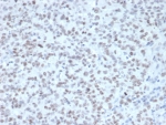 IHC staining of FFPE human tonsil tissue with Enhancer of zeste homolog 2 antibody (clone EZH2/4687). Inset: PBS used in place of primary Ab (secondary Ab negative control). HIER: boil tissue sections in pH 9 10mM Tris with 1mM EDTA for 20 min and allow to cool before testing.