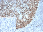 IHC staining of FFPE human tonsil tissue with EZH2 antibody (clone EZH2/6989). Inset: PBS used in place of primary Ab (secondary Ab negative control). HIER: boil tissue sections in pH 9 10mM Tris with 1mM EDTA for 20 min and allow to cool before testing.