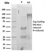 SDS-PAGE analysis of purified, BSA-free StAR antibody (clone STAR/3976) as confirmation of integrity and purity.
