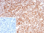 IHC staining of FFPE human tonsil tissue with Clusterin antibody (clone CLU/8865R). Inset: PBS used in place of primary Ab (secondary Ab negative control). HIER: boil tissue sections in pH 9 10mM Tris with 1mM EDTA for 20 min and allow to cool before testing.