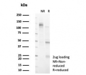 SDS-PAGE analysis of purified, BSA-free DBC1 antibody (clone PCRP-KIAA1967-1D10) as confirmation of integrity and purity.