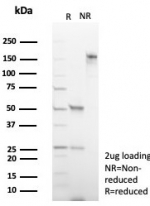 SDS-PAGE analysis of purified, BSA-free Deleted in breast cancer 2 antibody (clone DBC2/4570) as confirmation of integrity and purity.