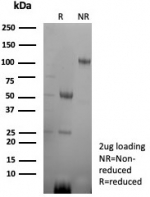 SDS-PAGE analysis of purified, BSA-free CA8 antibody (clone rCA8/8835) as confirmation of integrity and purity.