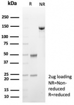 SDS-PAGE analysis of purified, BSA-free FABP4 antibody (clone rFABP4/8536) as confirmation of integrity and purity.
