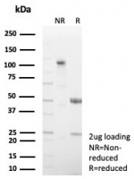 SDS-PAGE analysis of purified, BSA-free Fatty Acid Binding Protein 4 antibody (clone FABP4/8537R) as confirmation of integrity and purity.