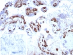 IHC staining of FFPE human placental tissue with Fatty Acid Binding Protein 4 antibody (clone FABP4/8537R) at 2ug/ml. Inset: PBS used in place of primary Ab (secondary Ab negative control). HIER: boil tissue sections in pH 9 10mM Tris with 1mM EDTA for 20 min and allow to cool before testing.