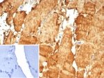 IHC staining of FFPE human skeletal muscle tissue with Carbonic Anhydrase 3 antibody (clone CA3/7883). Inset: PBS used in place of primary Ab (secondary Ab negative control). HIER: boil tissue sections in pH 9 10mM Tris with 1mM EDTA for 20 min and allow to cool before testing.