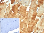 IHC staining of FFPE human skeletal muscle tissue with Carbonic Anhydrase 3 antibody (clone CA3/7884). Inset: PBS used in place of primary Ab (secondary Ab negative control). HIER: boil tissue sections in pH 9 10mM Tris with 1mM EDTA for 20 min and allow to cool before testing.