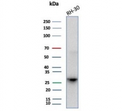 Western blot testing of human RH30 cell lysate with CA3 antibody (clone CA3/7885). Predicted molecular weight ~29 kDa.