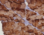 IHC staining of FFPE human skeletal muscle tissue with CA3 antibody (clone CA3/7885). HIER: boil tissue sections in pH 9 10mM Tris with 1mM EDTA for 20 min and allow to cool before testing.