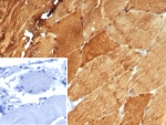 IHC staining of FFPE human skeletal muscle tissue with CA3 antibody (clone CA3/7885). Inset: PBS used in place of primary Ab (secondary Ab negative control). HIER: boil tissue sections in pH 9 10mM Tris with 1mM EDTA for 20 min and allow to cool before testing.