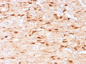 IHC staining of FFPE human brain tissue with NECAB1 antibody (clone NECAB1/7677). HIER: boil tissue sections in pH 9 10mM Tris with 1mM EDTA for 20 min and allow to cool before testing.