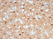 IHC staining of FFPE human brain tissue with NECAB1 antibody (clone NECAB1/7680). HIER: boil tissue sections in pH 9 10mM Tris with 1mM EDTA for 20 min and allow to cool before testing.