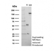 SDS-PAGE analysis of purified, BSA-free CALB1 antibody (clone rCALB1/8499) as confirmation of integrity and purity.