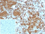 IHC staining of FFPE human pancreas tissue with Carboxypeptidase A1 antibody (clone CPA1/8258R). Inset: PBS used in place of primary Ab (secondary Ab negative control). HIER: boil tissue sections in pH 9 10mM Tris with 1mM EDTA for 20 min and allow to cool before testing.