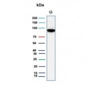 Western blot testing of human small intestine lysate with Cadherin 17 antibody (clone CDH17/8513R). Predicted molecular weight ~92 kDa but may be observed at higher molecular weights due to glycosylation.