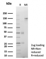 SDS-PAGE analysis of purified, BSA-free Cadherin 17 antibody (clone CDH17/8513R) as confirmation of integrity and purity.