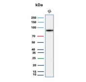 Western blot testing of human small intestine lysate with CDH17 antibody (clone CDH17/8515R). Predicted molecular weight ~92 kDa but may be observed at higher molecular weights due to glycosylation.