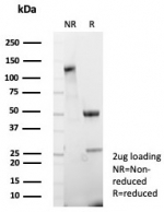 SDS-PAGE analysis of purified, BSA-free CDH17 antibody (clone CDH17/8515R) as confirmation of integrity and purity.
