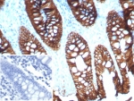 IHC staining of FFPE human colon tissue with CDH17 antibody (clone CDH17/8515R). Inset: PBS used in place of primary Ab (secondary Ab negative control). HIER: boil tissue sections in pH 9 10mM Tris with 1mM EDTA for 20 min and allow to cool before testing.