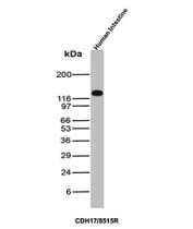 CDH17 Antibody Human Intestine WB. Western blot analysis of Cadherin-17 / CDH17, also known as Liver-intestine cadherin (LI-cadherin), expression in human intestine tissue lysate using rabbit monoclonal CDH17 antibody clone CDH17/8515R. Lane 1: human intestine lysate. A band is detected at approximately 110â130 kDa, consistent with the predicted molecular weight of CDH17, with the slightly higher apparent migration reflecting glycosylation of this intestinal epithelial adhesion protein. The strong signal in intestine lysate aligns with the known tissue-restricted expression of CDH17 in gastrointestinal epithelium.
