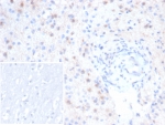 IHC staining of FFPE human brain tissue with EBAG9 antibody (clone rEBAG9/7264). Inset: PBS used in place of primary Ab (secondary Ab negative control). HIER: boil tissue sections in pH 9 10mM Tris with 1mM EDTA for 20 min and allow to cool before testing.