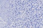 Negative control: IHC testing of FFPE human brain tissue with TRPS1 antibody (clone TRPS1/8131R) at 2ug/ml. HIER: boil tissue sections in pH 9 10mM Tris with 1mM EDTA for 20 min and allow to cool before testing.