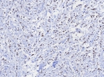 IHC staining of FFPE human uterus tissue with TRPS1 antibody; Strong nuclear staining observed with TRPS1/8131R at 2ug/ml. HIER: boil tissue sections in pH 9 10mM Tris with 1mM EDTA for 20 min and allow to cool before testing.
