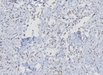 IHC staining of FFPE human uterus. Strong nuclear staining using TRPS1/8008R at 2ug/ml. HIER: boil tissue sections in pH 9 10mM Tris with 1mM EDTA for 20 min and allow to cool before testing.