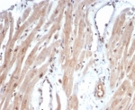 IHC staining of FFPE human heart tissue with c-Myc antibody (clone MYC/7855R). HIER: boil tissue sections in pH 9 10mM Tris with 1mM EDTA for 20 min and allow to cool before testing.