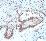 IHC staining of FFPE human cervix tissue with c-Myc antibody (clone MYC/7854R). HIER: boil tissue sections in pH 9 10mM Tris with 1mM EDTA for 20 min and allow to cool before testing.
