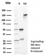 SDS-PAGE analysis of purified, BSA-free NTRK2 antibody (clone NTRK2/4672) as confirmation of integrity and purity.