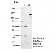 SDS-PAGE analysis of purified, BSA-free Adenylyl cyclase 8 antibody (clone ADCY8/7574) as confirmation of integrity and purity.