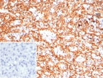IHC staining of FFPE human spleen tissue with Adenylyl cyclase 8 antibody (clone ADCY8/7574). HIER: boil tissue sections in pH 9 10mM Tris with 1mM EDTA for 20 min and allow to cool before testing.