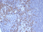 IHC staining of FFPE human lymph node tissue with PAX5 antibody (clone PCRP-PAX5-1B7). HIER: boil tissue sections in pH 9 10mM Tris with 1mM EDTA for 20 min and allow to cool before testing.
