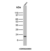 CDKN2A Antibody HeLa WB. Western blot analysis of Cyclin-dependent kinase inhibitor 2A (p16INK4a) expression in HeLa cell lysate using CDKN2A Antibody clone rCDKN2A/8004. Lane 1: HeLa cell lysate. A band is detected at approximately 15-17 kDa, consistent with the predicted molecular weight of p16INK4a, a cyclin-dependent kinase inhibitor that regulates G1 cell cycle progression through inhibition of CDK4 and CDK6. The clear signal supports the use of this clone for western blot analysis of proliferating cell lines.